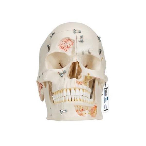 3B Scientific Deluxe Demonstration Skull, Dental Skull, 10 part, w/ 3B Smart Anatomy 1000059